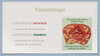 Fisiopatologia
ESTATICA
DINAMICA
 