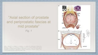 “Axial section of prostate
and periprostatic fascias at
mid prostate”
 