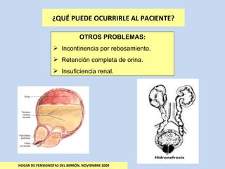 HOGAR DE PENSIONISTAS DEL BERRÓN. NOVIEMBRE 2009 ¿QUÉ PUEDE OCURRIRLE AL PACIENTE? OTROS PROBLEMAS: Incontinencia por rebosamiento. Retención completa de orina. Insuficiencia renal. 