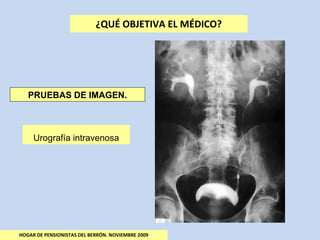¿QUÉ OBJETIVA EL MÉDICO? HOGAR DE PENSIONISTAS DEL BERRÓN. NOVIEMBRE 2009 PRUEBAS DE IMAGEN. Urografía intravenosa 