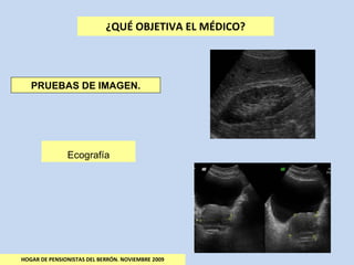 ¿QUÉ OBJETIVA EL MÉDICO? HOGAR DE PENSIONISTAS DEL BERRÓN. NOVIEMBRE 2009 PRUEBAS DE IMAGEN. Ecografía 