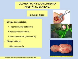 ¿CÓMO TRATAR EL CRECIMIENTO PROSTÁTICO BENIGNO? HOGAR DE PENSIONISTAS DEL BERRÓN. NOVIEMBRE 2009 Cirugía: Tipos  Cirugía endoscópica. Trígonocervicoprostatomía. Resección transuretral. Fotovaporización (láser verde). Cirugía abierta. Adenomectomía. 