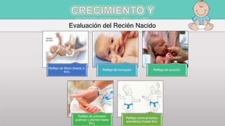 Evaluación del Recién Nacido
Reflejo de Moro (hasta 2-
4m).
Reflejo de hociqueo Reflejo de succión
Reflejo de prensión
(palmar o plantar hasta
5m).
Reflejo cervical tónico
asimétrico (hasta 6m)
 