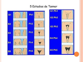 5 Estadios de Tanner
 