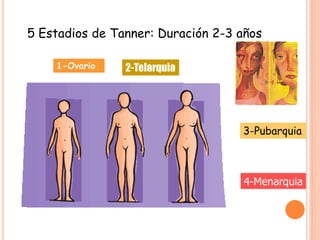5 Estadios de Tanner: Duración 2-3 años
1-Ovario 2-Telarquia
3-Pubarquia
4-Menarquia
 