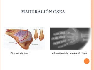 MADURACIÓN ÓSEA
Crecimiento óseo Valoración de la maduración ósea
 