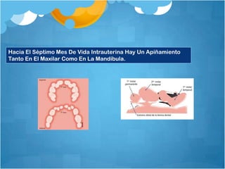 Hacia El Séptimo Mes De Vida Intrauterina Hay Un Apiñamiento
Tanto En El Maxilar Como En La Mandíbula.
 