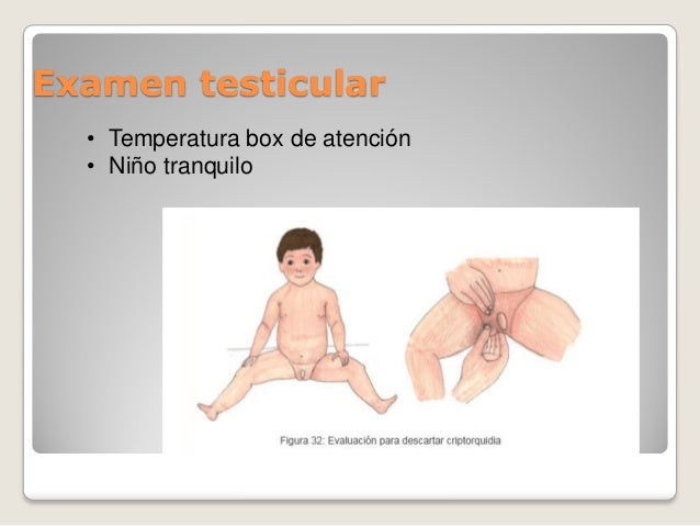 Kartalin las revocaciones por el tratamiento de la psoriasis