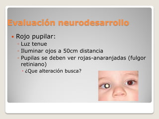 Evaluación neurodesarrollo
 Rojo pupilar:
◦ Luz tenue
◦ Iluminar ojos a 50cm distancia
◦ Pupilas se deben ver rojas-anaranjadas (fulgor
retiniano)
 ¿Que alteración busca?
 
