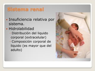 Sistema renal
 Insuficiencia relativa por inmadurez del
sistema.
 Hidrolabilidad
◦ Distribución del liquido
corporal (extracelular)
◦ Composición corporal de
liquido (es mayor que del
adulto)
 