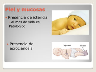 Piel y mucosas
 Presencia de ictericia
◦ Al mes de vida es
Patológico
 Presencia de
acrocianosis
 