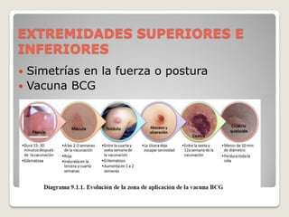 EXTREMIDADES SUPERIORES E
INFERIORES
 Simetrías en la fuerza o postura
 Vacuna BCG
 