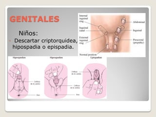 GENITALES
Niños:
◦ Descartar criptorquidea,
hipospadia o epispadia.
◦
 