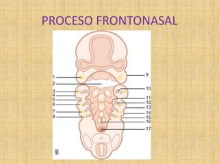 PROCESO FRONTONASAL
 