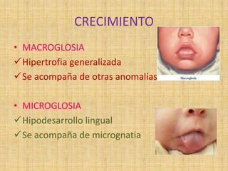 CRECIMIENTO
• MACROGLOSIA
Hipertrofia generalizada
Se acompaña de otras anomalías
• MICROGLOSIA
Hipodesarrollo lingual
Se acompaña de micrognatia
 