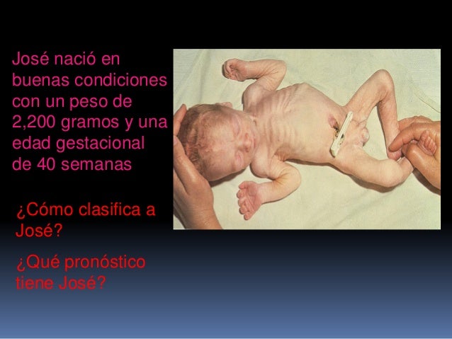 Crecimiento Y Desarrollo Neonato 16