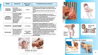 12
Reflejo Importancia Edad en que
aparece
Procedimiento para valoración
 