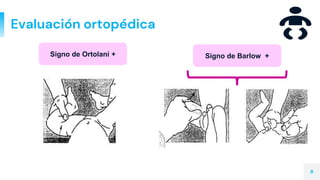 Evaluación ortopédica
8
Signo de Ortolani + Signo de Barlow +
 