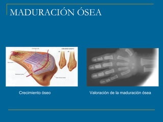 MADURACIÓN ÓSEA 
Crecimiento óseo Valoración de la maduración ósea 
 