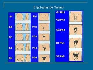 5 Estadios de Tanner 
 