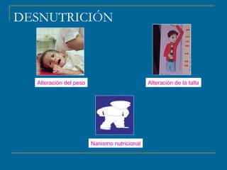 DESNUTRICIÓN 
Alteración del peso Alteración de la talla 
Nanismo nutricional 
 