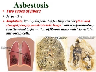 Asbestosis
• Two types of fibers
 Serpentine
 Amphibole: Mainly responsible for lung cancer (thin and
straight) deeply penetrate into lungs, causes inflammatory
reaction lead to formation of fibrous mass which is visible
microscopically.
 