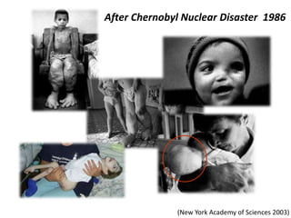 After Chernobyl Nuclear Disaster 1986
(New York Academy of Sciences 2003)
 