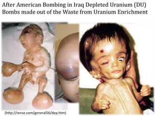 After American Bombing in Iraq Depleted Uranium (DU)
Bombs made out of the Waste from Uranium Enrichment
(http://rense.com/general56/dep.htm)
 
