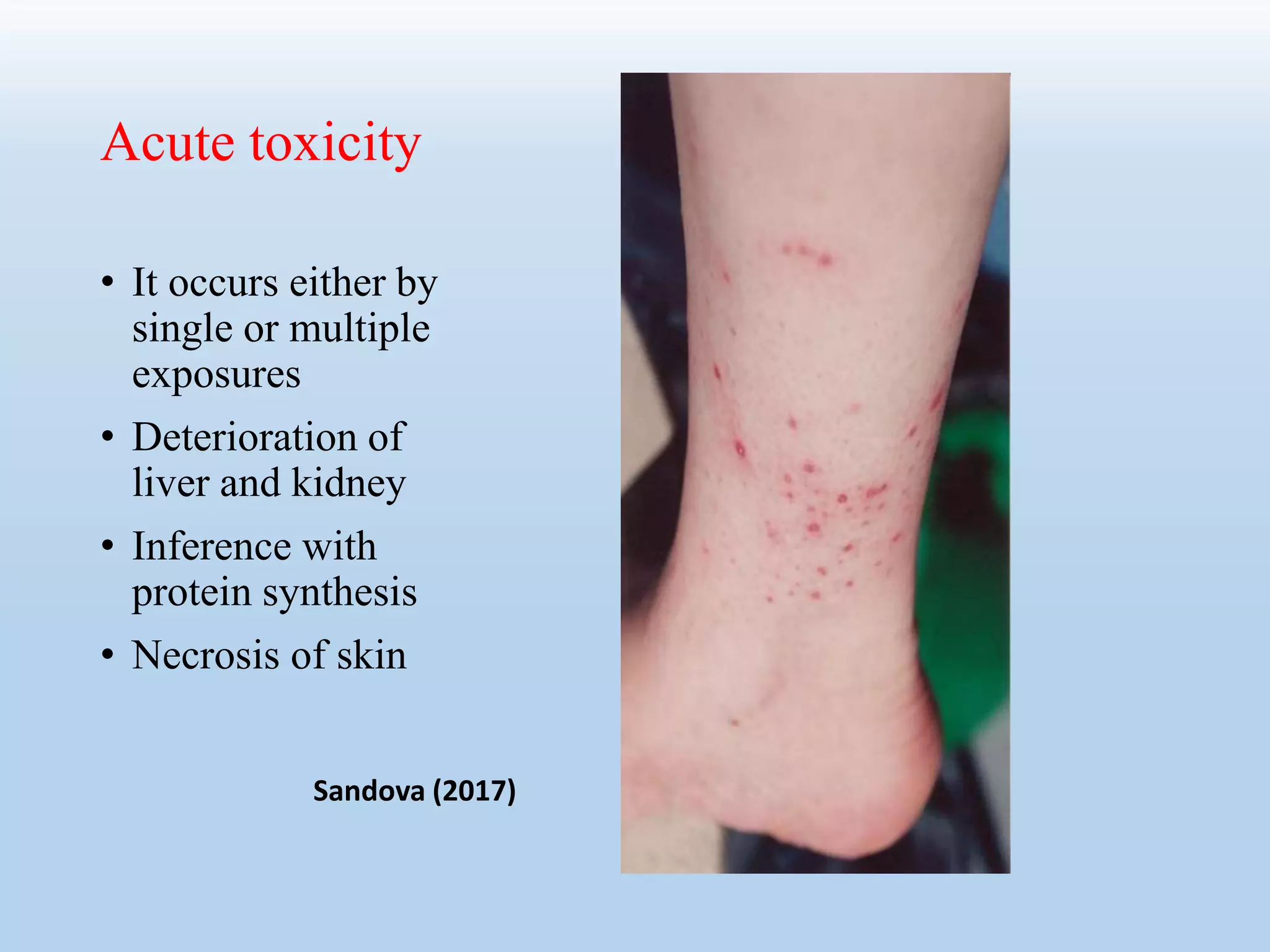 Acute toxicity
• It occurs either by
single or multiple
exposures
• Deterioration of
liver and kidney
• Inference with
protein synthesis
• Necrosis of skin
Sandova (2017)
 