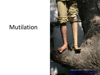  MutilationImage used under a  CC license from http://www.flickr.com/photos/xclockwise/520742585/