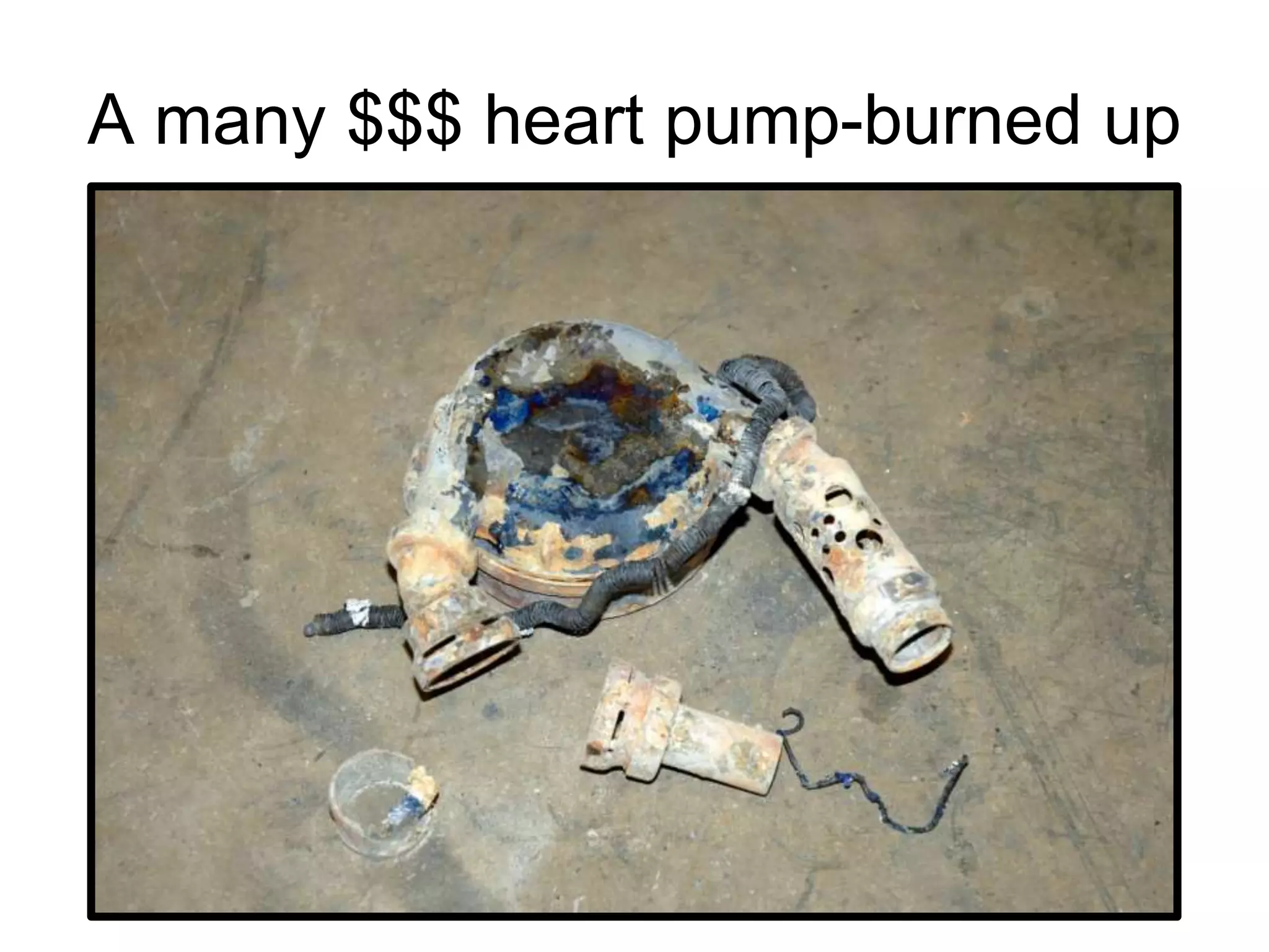 A many $$$ heart pump-burned up
 