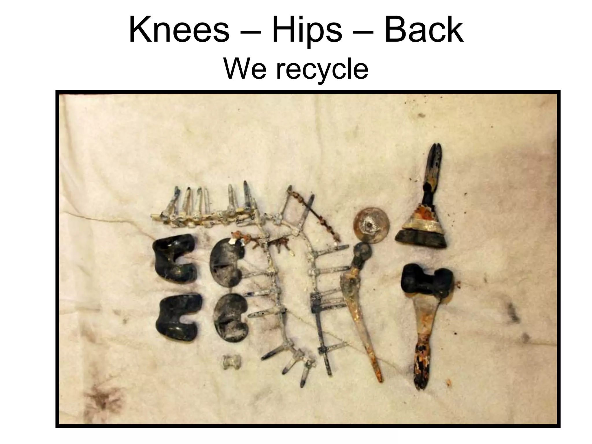 Knees – Hips – Back
We recycle
 