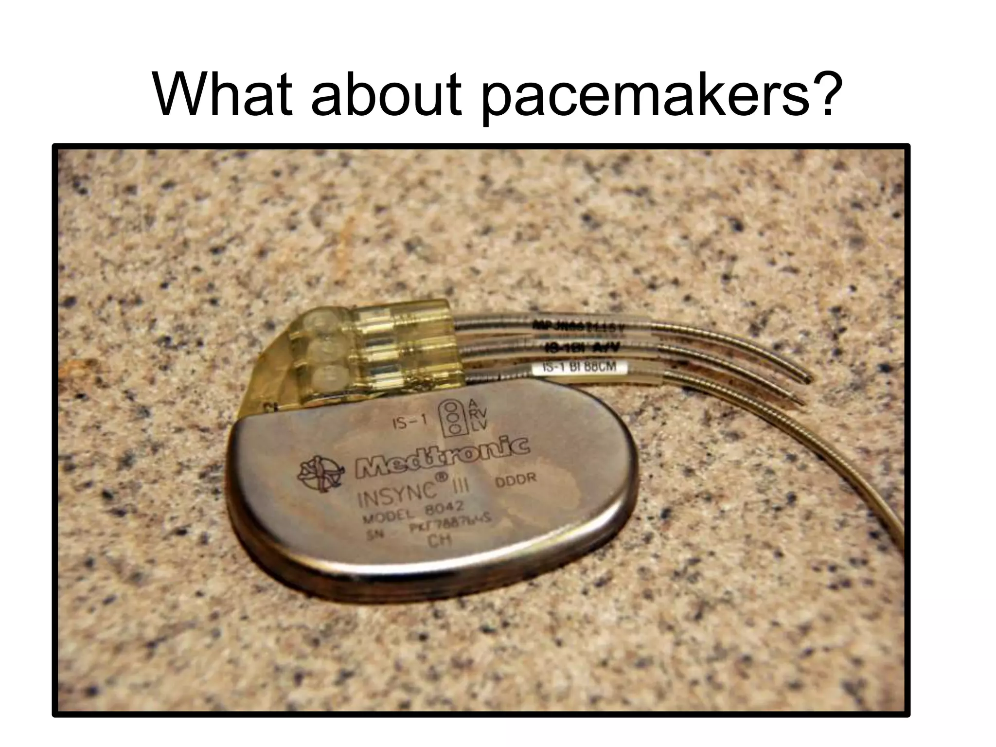 What about pacemakers?
 