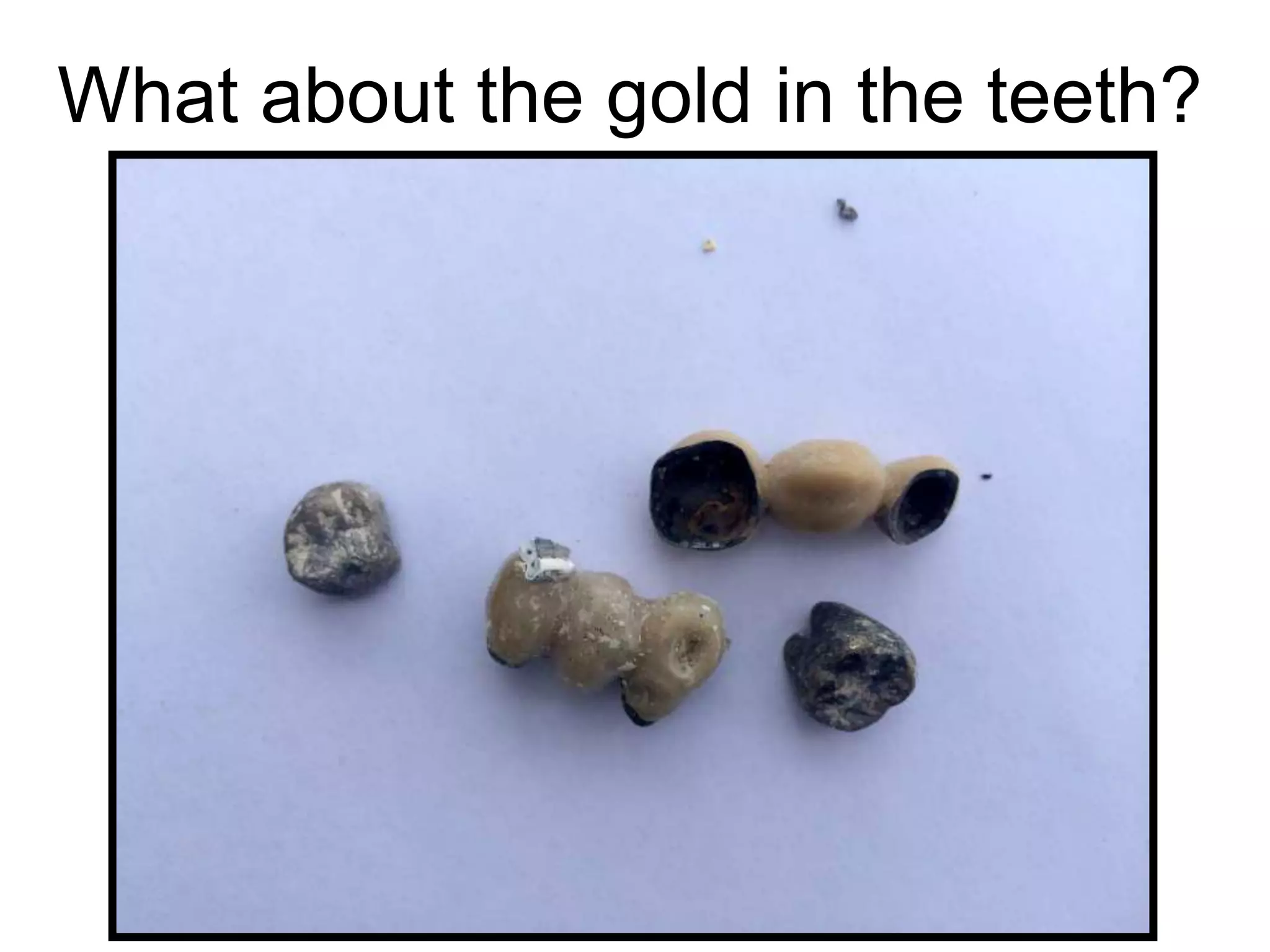 What about the gold in the teeth?
 