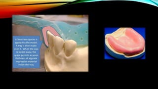 CD clinical tricks (ADEC one day CD)