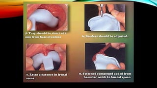 CD clinical tricks (ADEC one day CD)