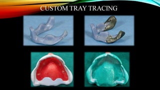 CD clinical tricks (ADEC one day CD)