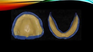 CD clinical tricks (ADEC one day CD)