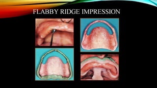 CD clinical tricks (ADEC one day CD)