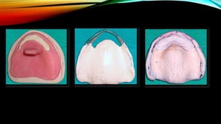 CD clinical tricks (ADEC one day CD)