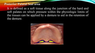 CD clinical tricks (ADEC one day CD)