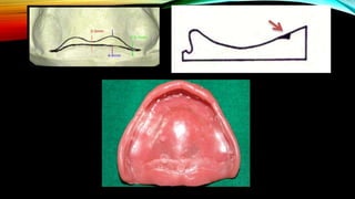 CD clinical tricks (ADEC one day CD)