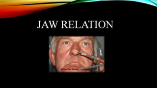 CD clinical tricks (ADEC one day CD)