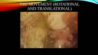 CD clinical tricks (ADEC one day CD)