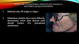 CD clinical tricks (ADEC one day CD)