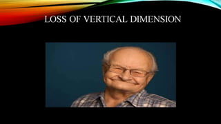 CD clinical tricks (ADEC one day CD)