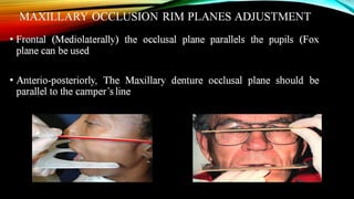 CD clinical tricks (ADEC one day CD)