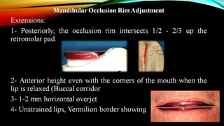 CD clinical tricks (ADEC one day CD)