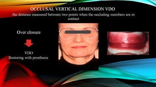 CD clinical tricks (ADEC one day CD)