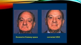 CD clinical tricks (ADEC one day CD)